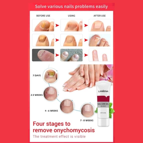 - LANBENA Nail Care Gel 20g - SHOPEE MALL | Sri Lanka