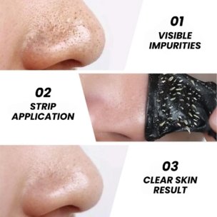 Deep Cleansing Blackhead Removal Strips for Nose - Pack of 10 - Image 2